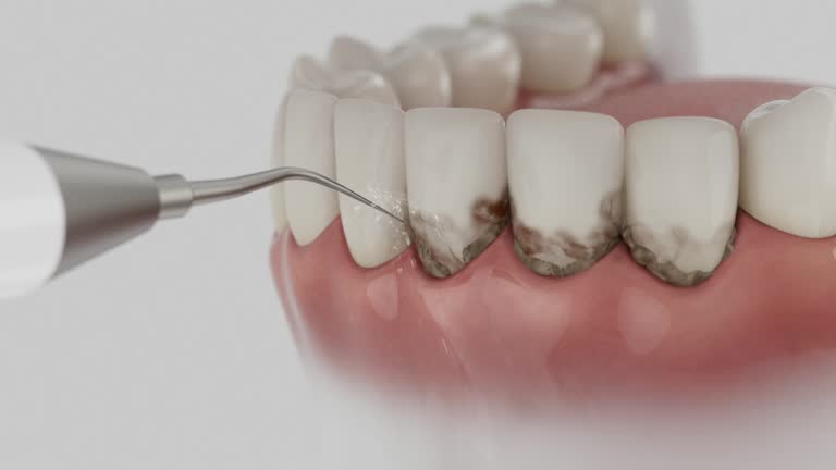 Trusted Teeth Cleaning And Checkup service in Villa Grove, IL - Dentist Open Now
